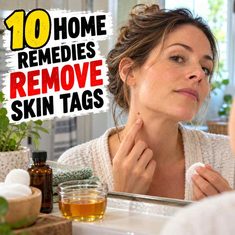 10 Home Remedies To Remove Skin Tags 10 Home Remedies To Remove Skin Tags