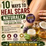 10 Ways To Heal Scars Naturally