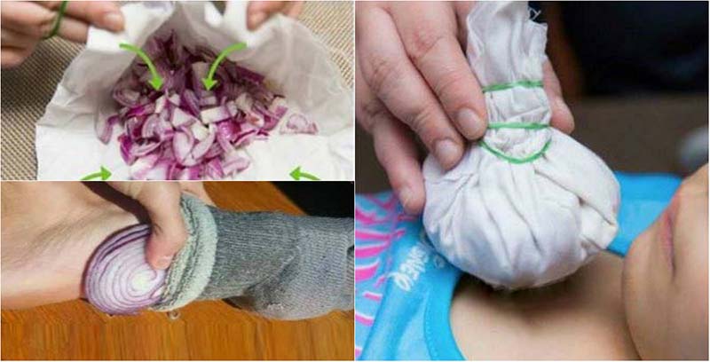 11 Home Remedies Using Onions That Really Work