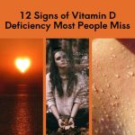 12 Signs of Vitamin D Deficiency Most People Miss