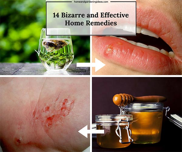 14 Bizarre & Unlikely Home Remedies