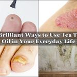 14 Brilliant Ways to Use Tea Tree Oil in Your Everyday Life