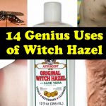 14 Genius Uses of Witch Hazel