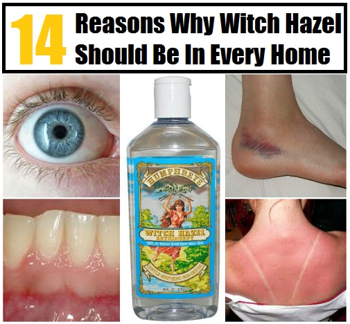 14 Reasons Witch Hazel Should be in your Medicine Cabinet