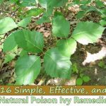 If you’re an avid camper or an outdoor junkie, chances are you’ve had a few bouts with some nasty poison ivy—it’s just a fact of life. It can be an unexpected setback, but a bit of poison ivy rash can be taken care of in a multitude of ways. Whether you have the many ingredients at home available, or you are caught with a rash out in the wild, this list of soothing measures can serve you and relieve pain, itchiness, blisters, and inflammation. Be it on the trail or in your backyard, try out these effective, natural, and easy cures and soothers for poison ivy.