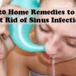 20 Home Remedies to Get Rid of Sinus Infection