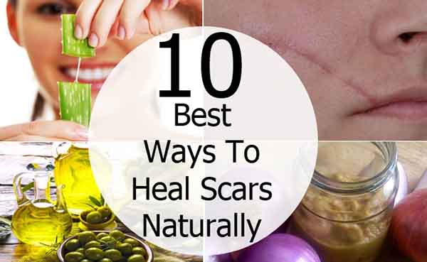 10 Ways To Heal Scars Naturally