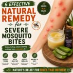 6 Effective Natural Remedy for Severe Mosquito Bites