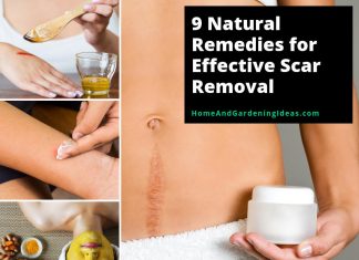 9 Ways To Heal Scars Naturally 9-Natural-Remedies-for-Effective-Scar-Removal