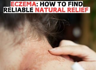 Eczema: How to Find Reliable Natural Relief Eczema: How to Find Reliable Natural Relief