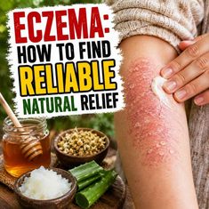 Eczema: How to Find Reliable Natural Relief Eczema: How to Find Reliable Natural Relief