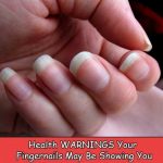 11 Health Warnings Your Fingernails May Be Showing You