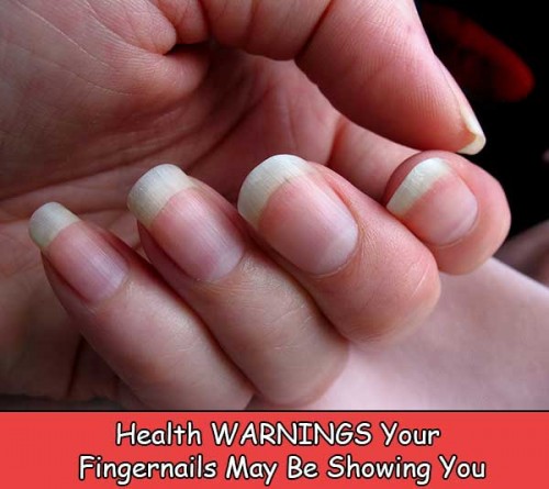 11 Health Warnings Your Fingernails May Be Showing You 