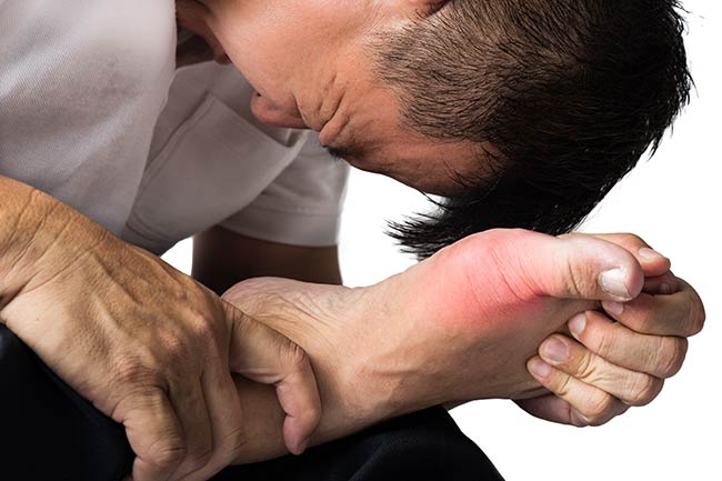 9 Home Remedies For Gout Pain