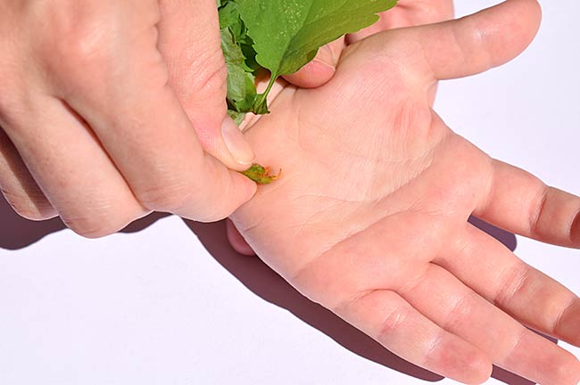 Home Remedies To Get Rid of Warts