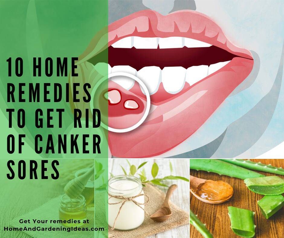 Home Remedies to Get Rid Of Canker Sores