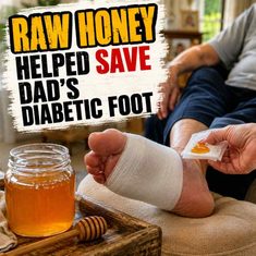 How Raw Honey Helped Save Her Dads Diabetic Foot How Raw Honey Helped Save Her Dads Diabetic Foot