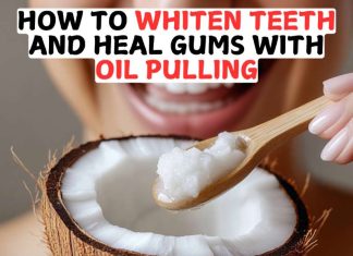 How To Whiten Teeth And Heal Gums With Oil Pulling How To Whiten Teeth And Heal Gums With Oil Pulling
