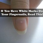 If You Have White Marks On Your Fingernails, Read This!