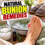 Natural Bunion remedies