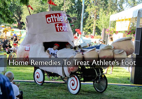 Home Remedies To Treat Athlete’s Foot
