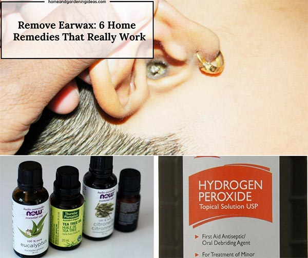 6 Simple Home Remedies To Help Remove Ear Wax