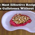 The Most Effective Recipe to Remove Gallstones Without Surgery