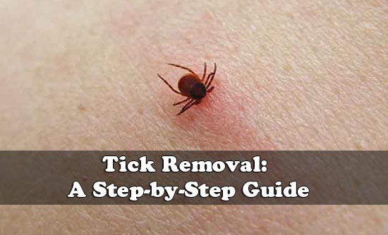 Tick Removal: A Step-by-Step Guide